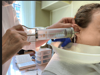 Microsuction ear wax removal clinic assessment